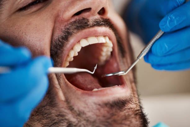 Best Emergency Treatment for Oral Infections in Sylvan Springs, AL